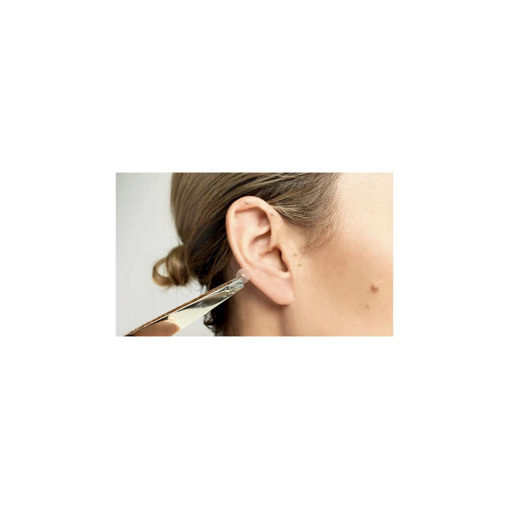 Auricular therapy